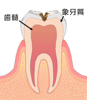 タイトル