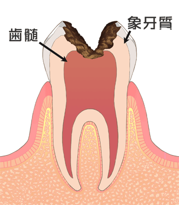 タイトル